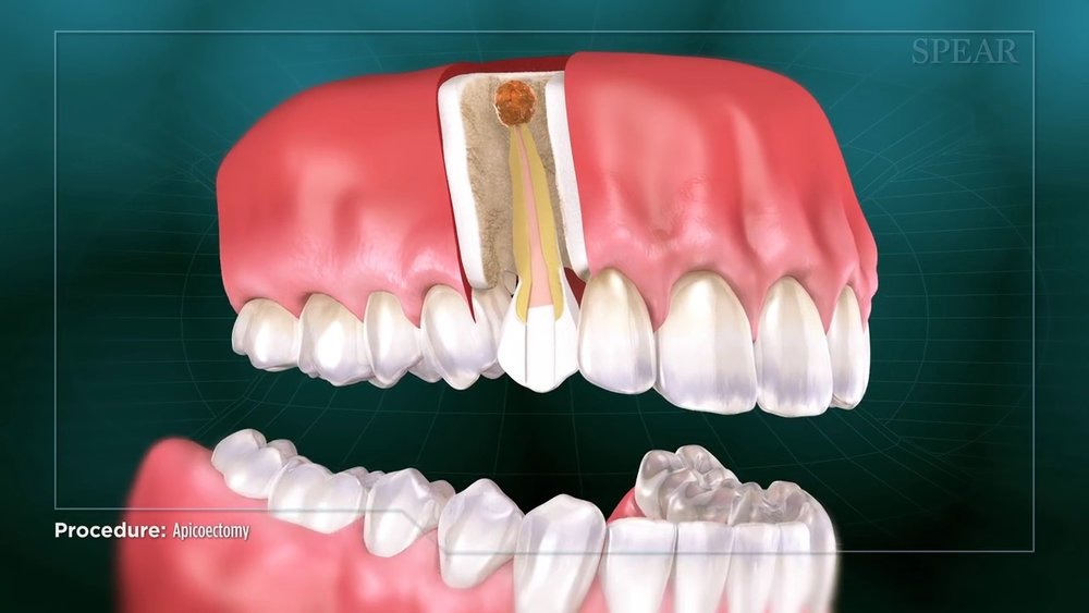 healthy teeth