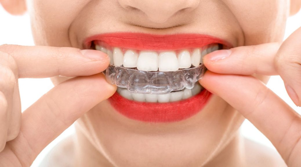 Tooth Filling Treatment