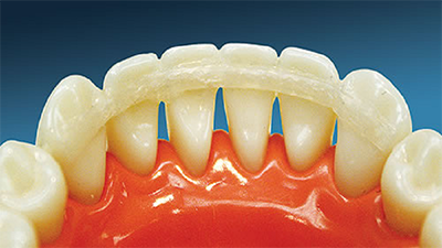 mouth cancer
