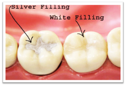 tooth implant procedure